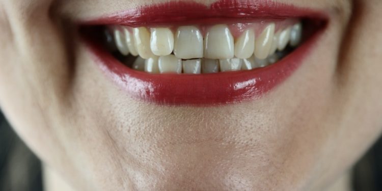 Dealing with Sensitive Teeth and Sharp Pain