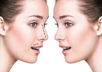 Everything you need to know about the nose job in Turkey
