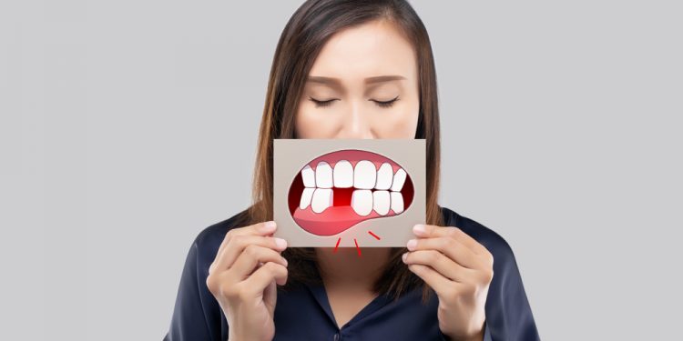 Replacing missing teeth in Ireland – What options are available?