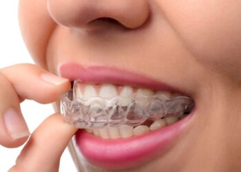 What Is the Right Age for Dental Braces?