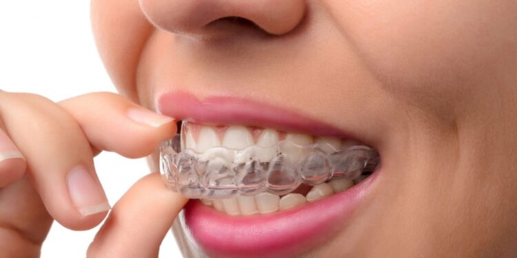 What Is the Right Age for Dental Braces?