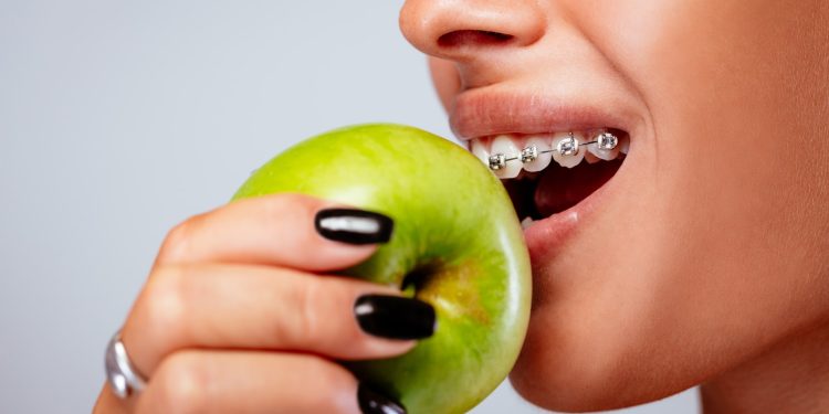 Which foods and drinks affect your teeth and gums?