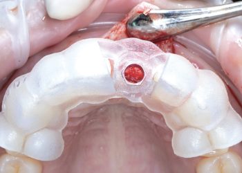 Comprehensive Guide to Surgery: Types, Techniques, and Patient Care