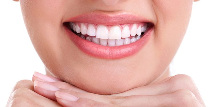 Smile Transformations Made Possible Through Modern Dentistry